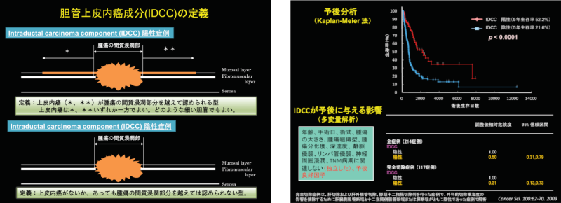 IDCCの定義（左）と予後（右）との関係