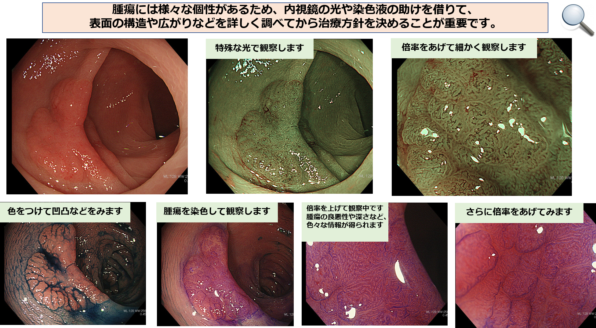 当院の大腸内視鏡検査について