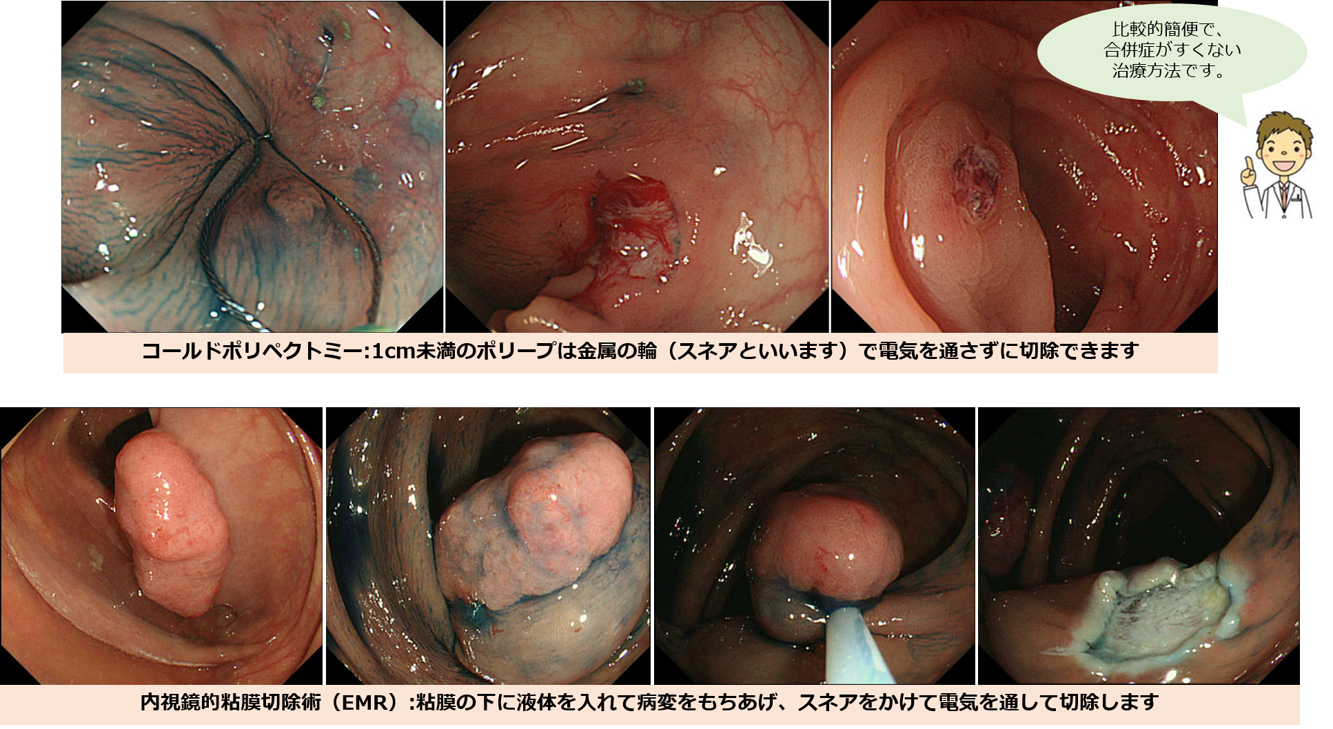 当院の大腸内視鏡検査について