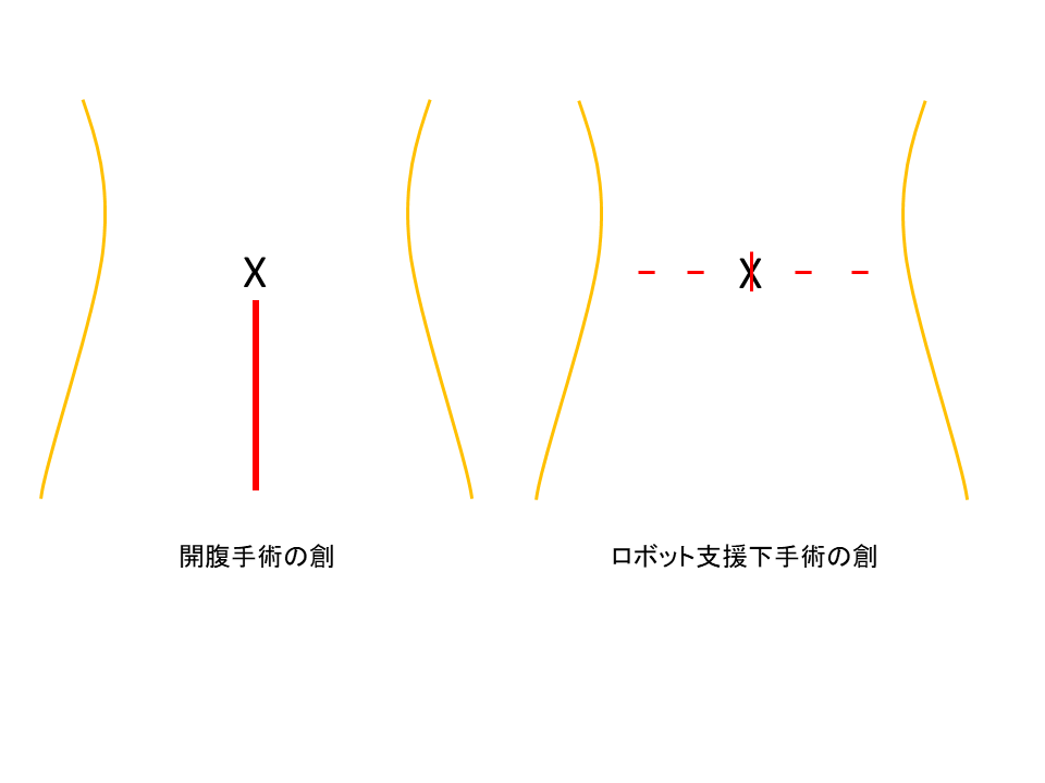 手術創の図