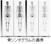 核医学（RI検査）とは？